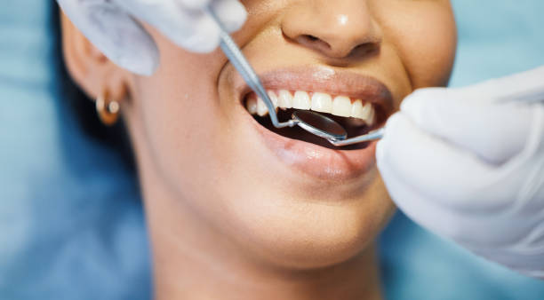 Best Chipped Tooth Repair Near Me  in Mabank, TX